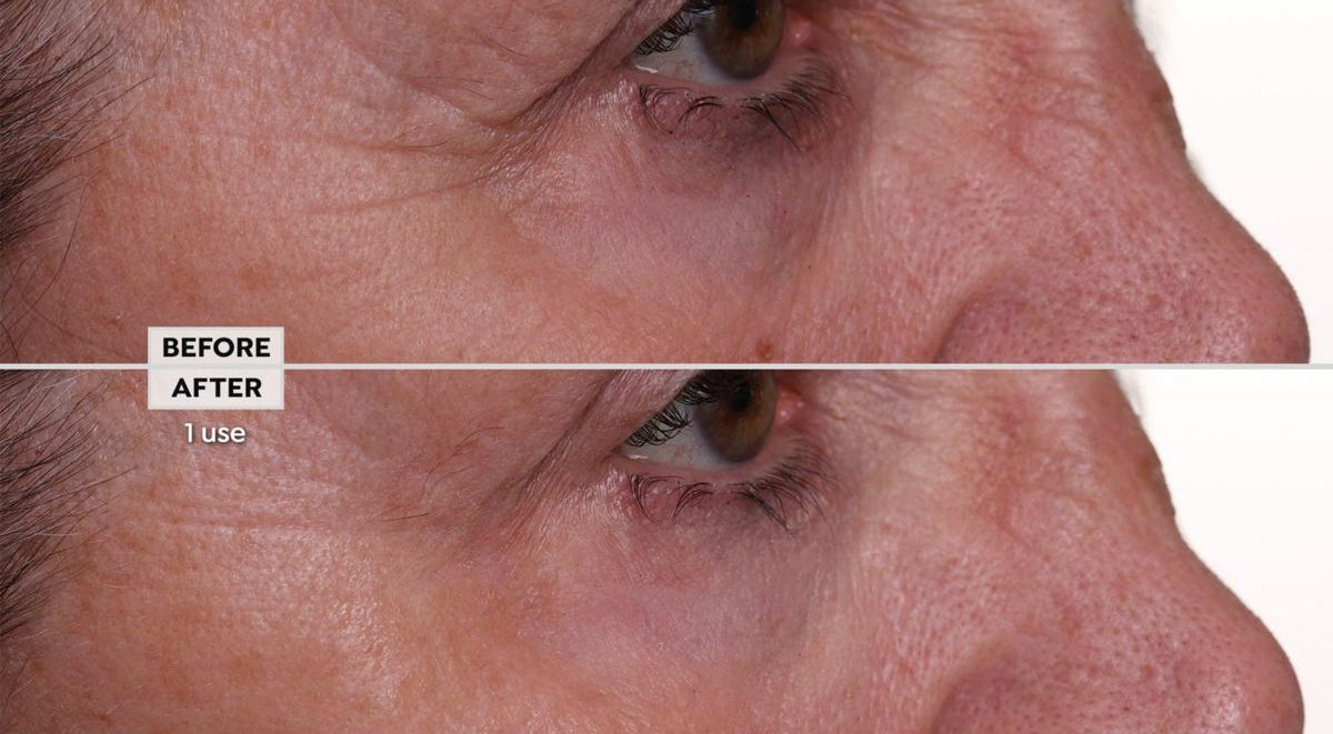 Face Reset Anhydrous Eye Balm