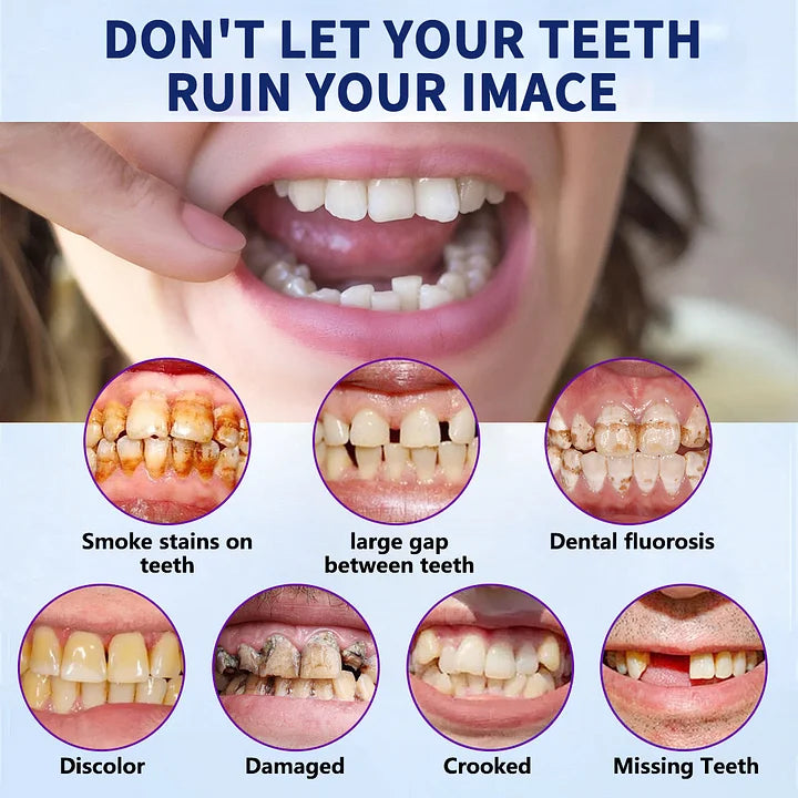 (⏰Limited-time offer: only $9.9⏰)🦷Advanced Customized Full Denture Set🦷