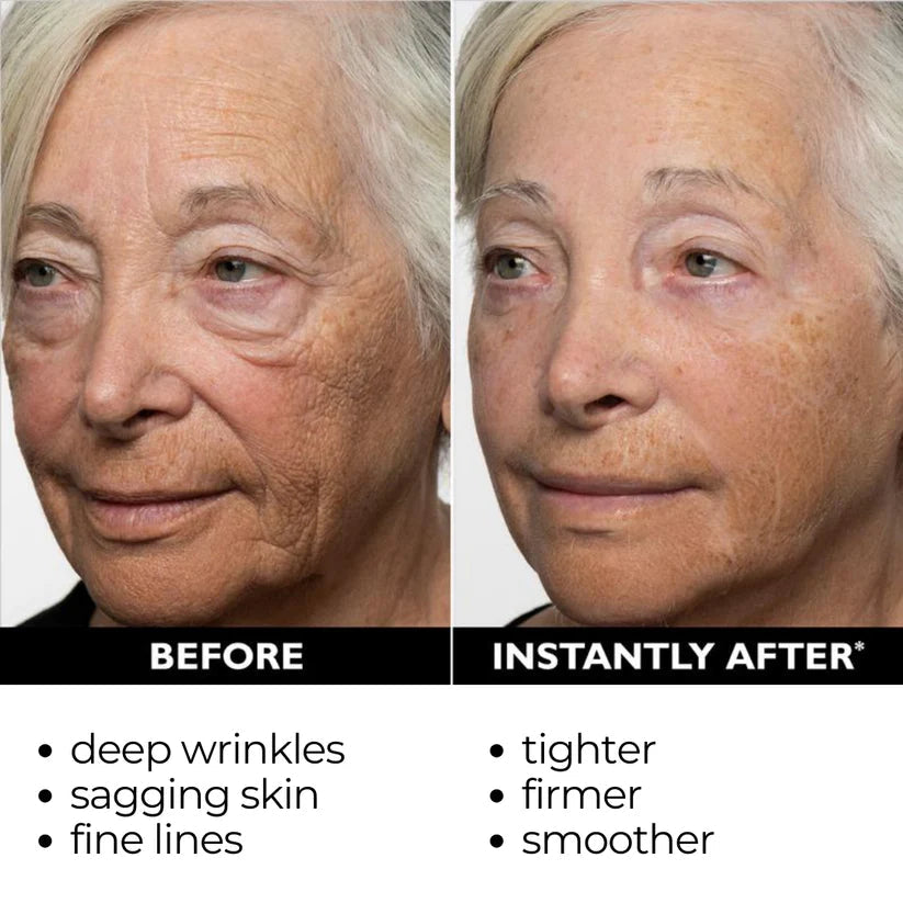 đ„ăOfficial Brand StoreăInstant Temporary Face Tightenerâ 80% OFF!