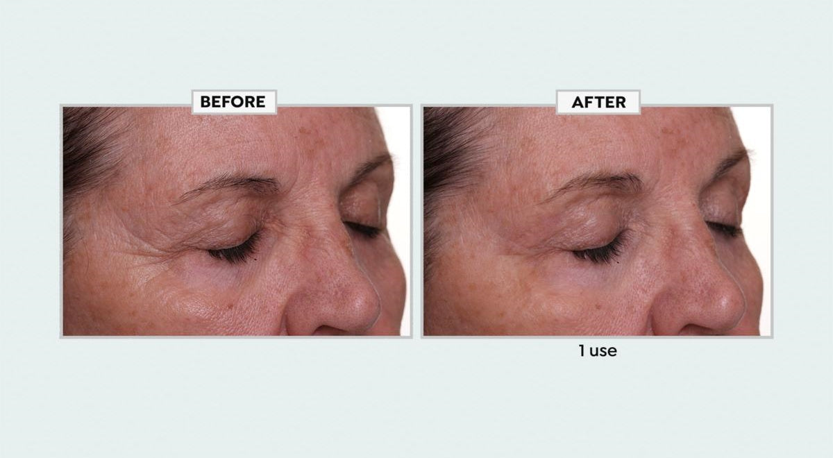 Face Reset Anhydrous Eye Balm
