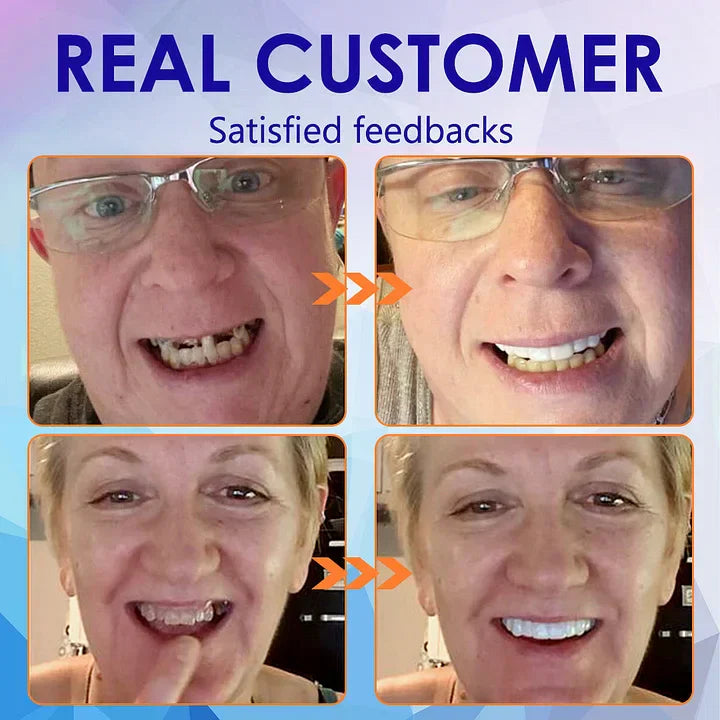 (⏰Limited-time offer: only $9.9⏰)🦷Advanced Customized Full Denture Set🦷
