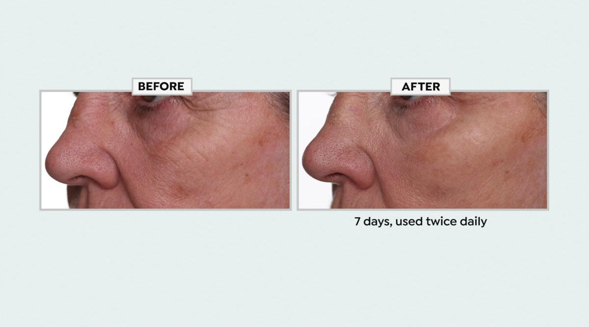 Face Reset Anhydrous Eye Balm