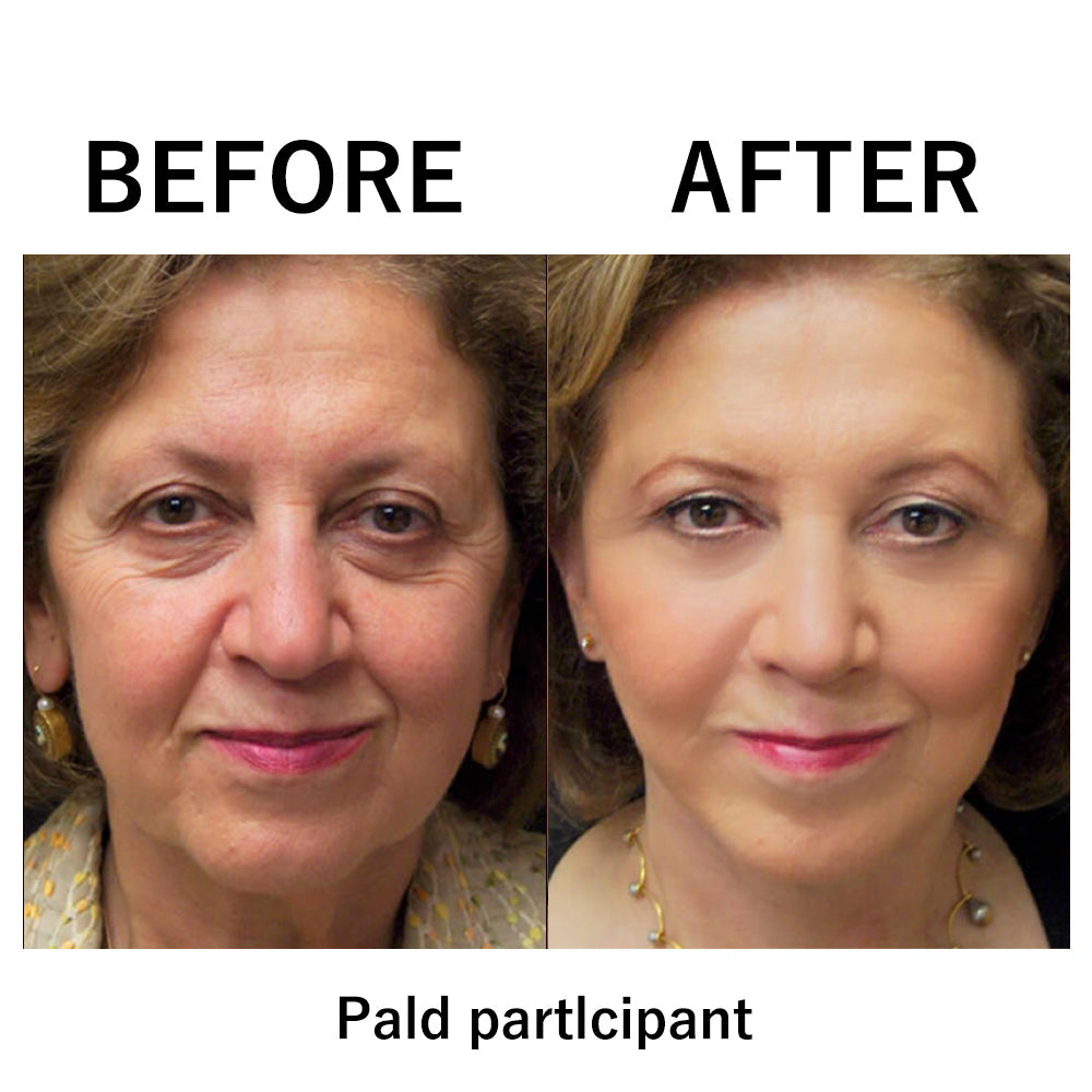 đ„ăOfficial Brand StoreăInstant Temporary Face Tightenerâ 80% OFF!