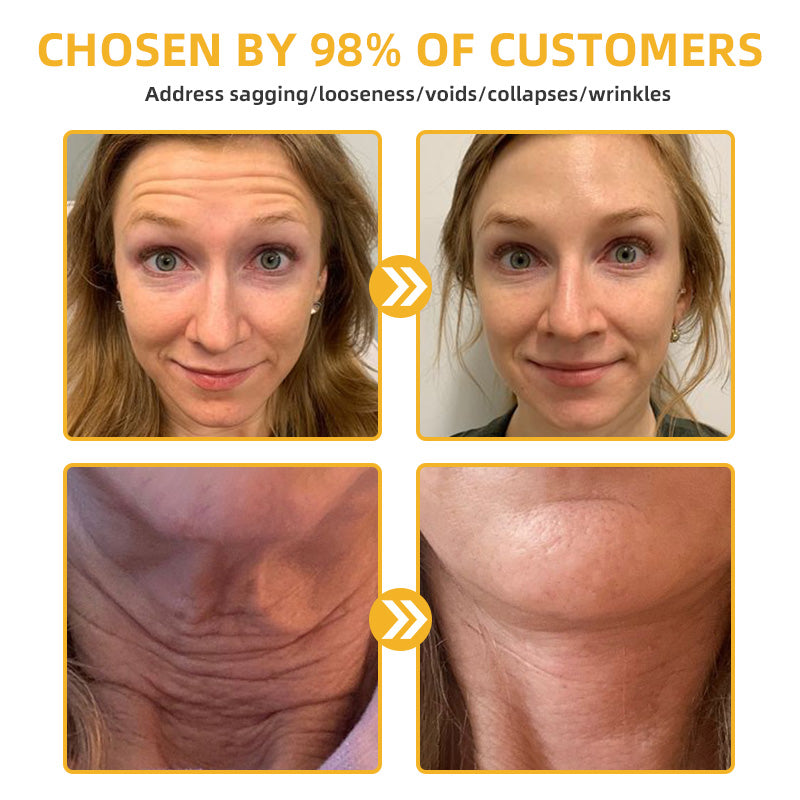 💐🐝HZA™ BeeLift Anti-Aging Firming Cream,Address Crepe & Sagging(🔥74% Off for a Limited Time!)