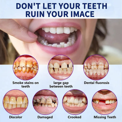 (⏰Limited-time offer: only $9.9⏰)🦷Advanced Customized Full Denture Set🦷