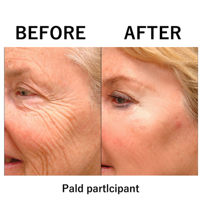 🔥【Official Brand Store】Instant Temporary Face Tightener– 80% OFF!