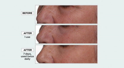 Face Reset Anhydrous Eye Balm