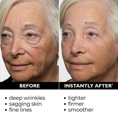 🔥【Official Brand Store】Instant Temporary Face Tightener– 80% OFF!