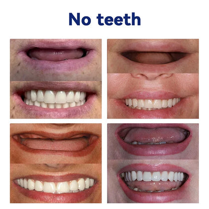 (⏰Limited-time offer: only $9.9⏰)🦷Advanced Customized Full Denture Set🦷